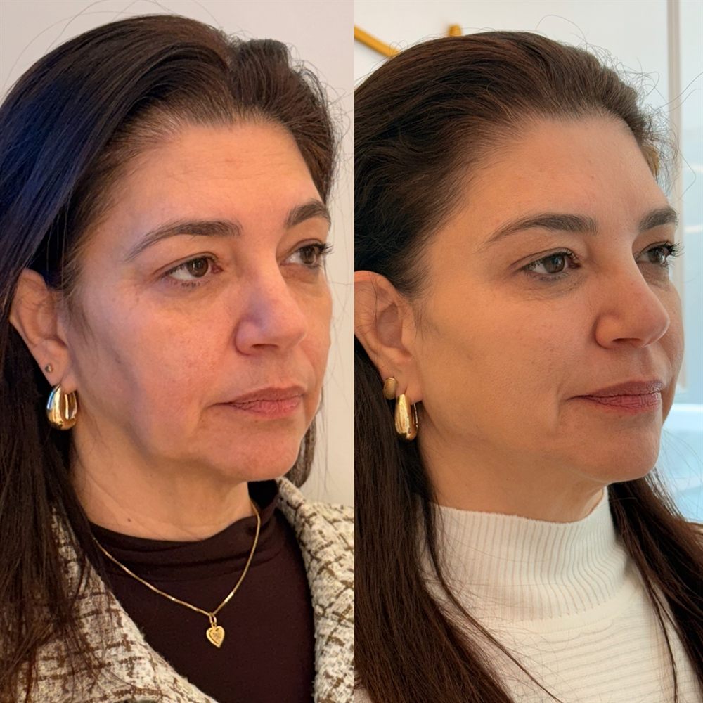 Comparativo de antes e depois — Caso 03