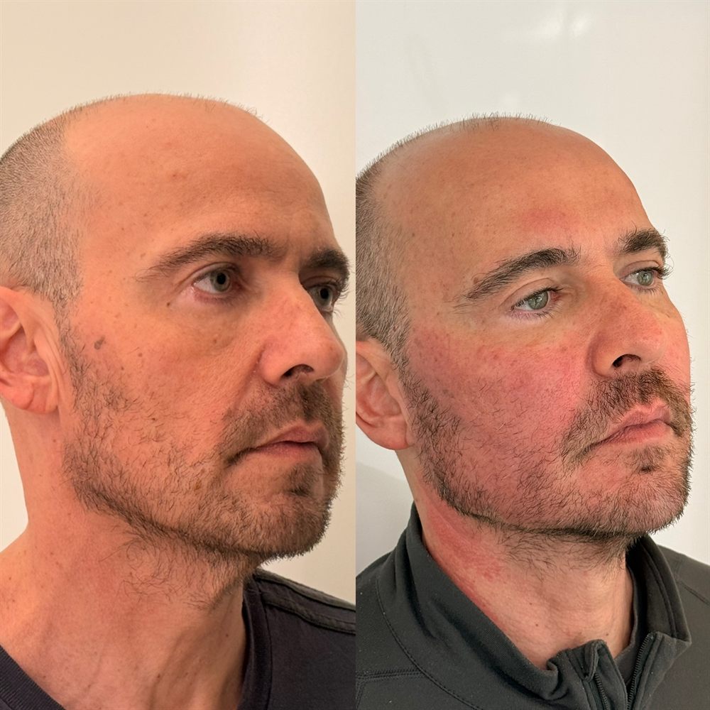 Comparativo de antes e depois — Caso 04